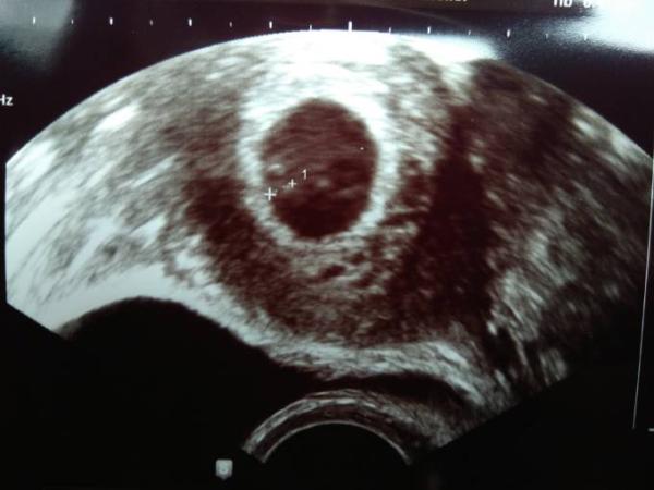 Bild zu 1. Gyn-Termin - Forum für Dezember - Mamis