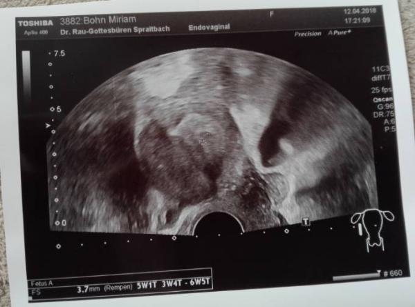 Bild zu 1US Bild nachgereicht - Forum für Dezember - Mamis