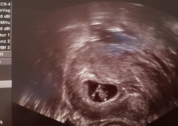 Bild zu Endlich beim FA gewesen - ET 1.12.2018 - Forum für Dezember - Mamis