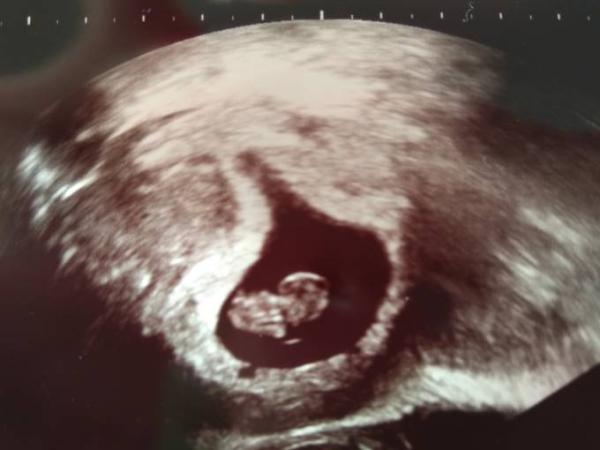 Bild zu Gyn Termin mit Bild - Forum für Dezember - Mamis