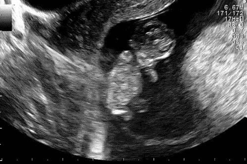 Bild zu FA-Termin und Foto - Forum für Dezember - Mamis