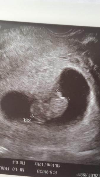 Bild zu 1. Ultraschall - Forum für Dezember - Mamis