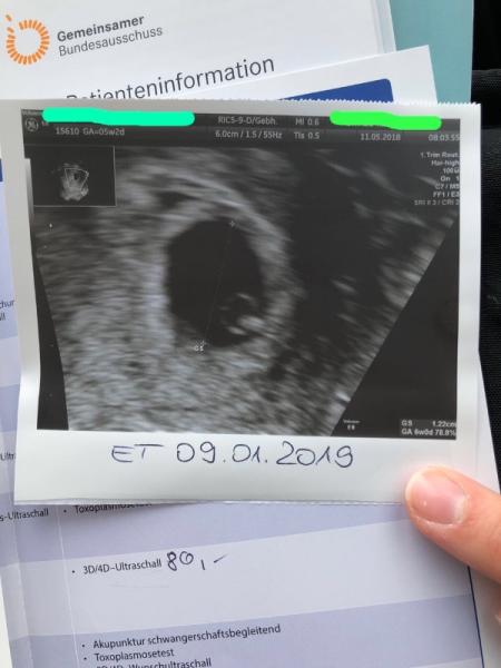 Bild zu 1. Termin heute ❤️❤️❤️ - Forum für Dezember - Mamis