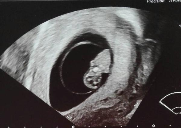 Bild zu Termin heute ❤ - Forum für Dezember - Mamis