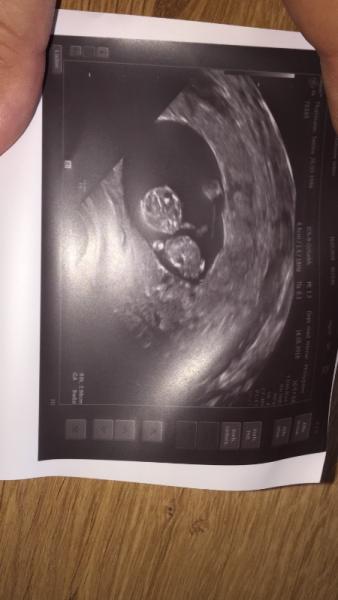 Bild zu FA Termin gestern ❤️ - Forum für Dezember - Mamis
