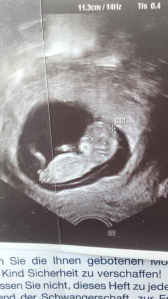 Bild zu 2. Ultraschall - Forum für Dezember - Mamis