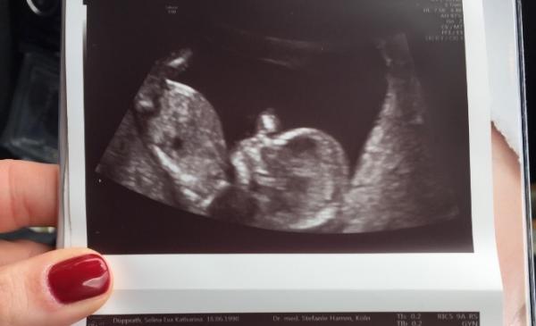 Bild zu Ich Platze vor stolz und liebe - Forum für Dezember - Mamis