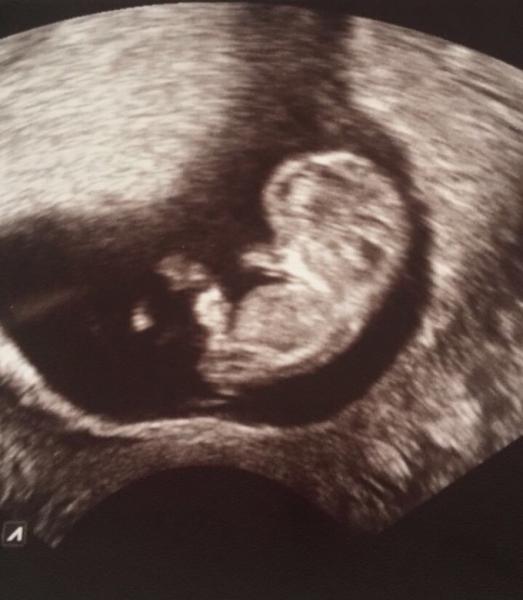 Bild zu Auch mal Hallo sagen... - Forum für Dezember - Mamis