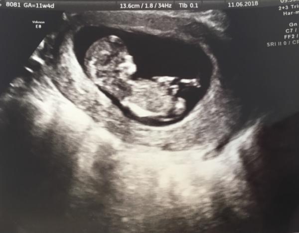 Bild zu Baby-TV - Forum für Dezember - Mamis