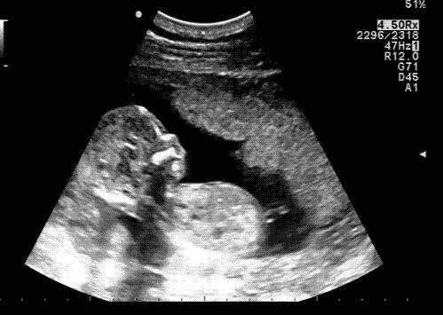 Bild zu FA-Termin und Foto - Forum für Dezember - Mamis