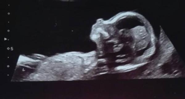 Bild zu Ich bin soooo verliebt 😍 - Forum für Dezember - Mamis