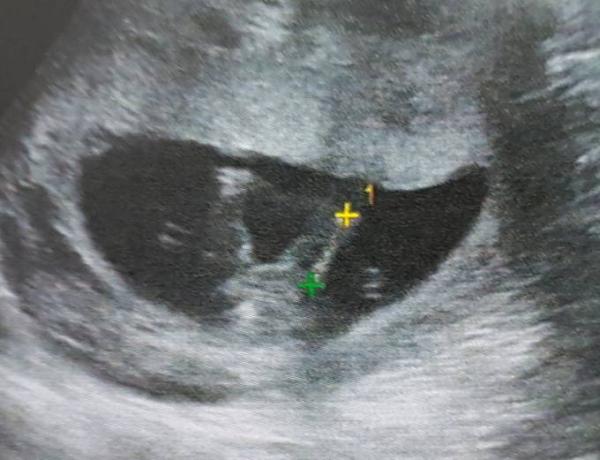 Bild zu Junge oder Mädchen? - Forum für Dezember - Mamis