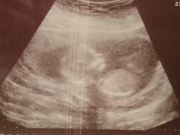 Bild zu Ich bin aufs neue verliebt 😍 - Forum für Dezember - Mamis