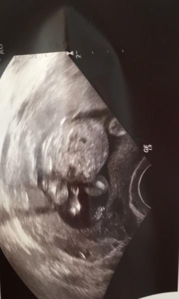 Bild zu Baby Outing - Forum für Dezember - Mamis