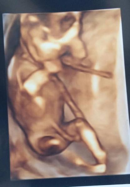 Bild zu Sieht doch komisch aus.. - Forum für Dezember - Mamis