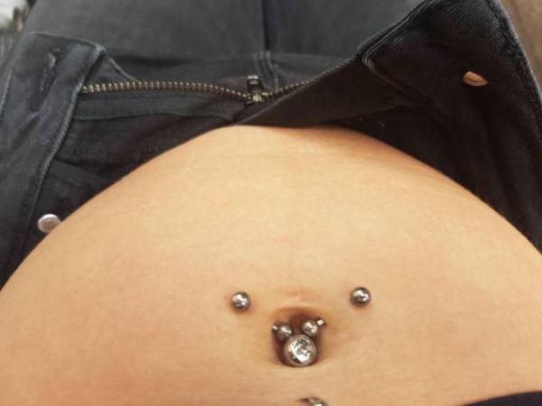 Bild zu Linea Nigra - Forum für Dezember - Mamis