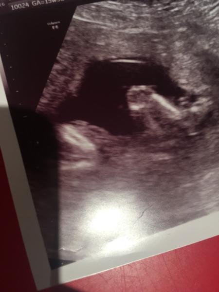 Bild zu Unser Termin zum 40. - Forum für Dezember - Mamis