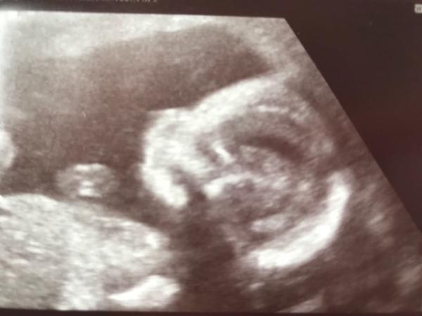 Bild zu Wir gehören zum Team... - Forum für Dezember - Mamis