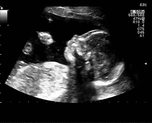 Bild zu Wie verliebt kann man sein 😍💙 - Forum für Dezember - Mamis