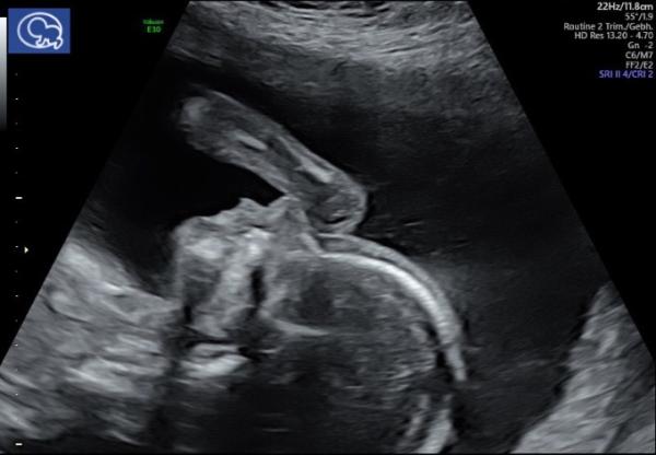 Bild zu Heute Organscreening gehabt... - Forum für Dezember - Mamis