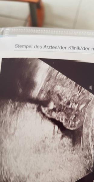 Bild zu Junge oder Mädchen? - Forum für Dezember - Mamis
