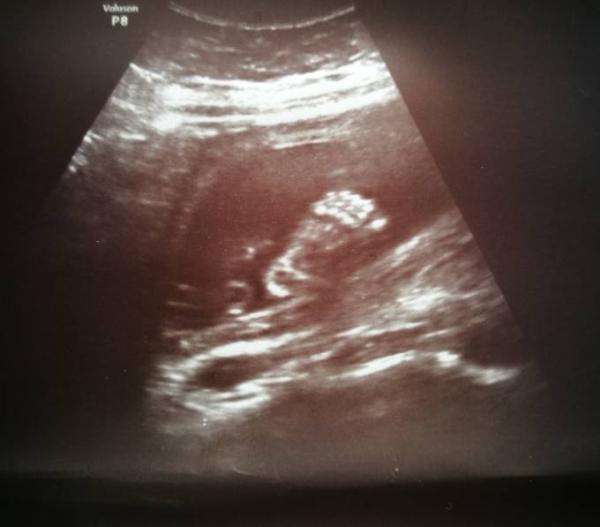 Bild zu Moin moin - Forum für Dezember - Mamis