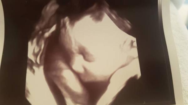 Bild zu Gebärmutterhals bei 3cm - Forum für Dezember - Mamis