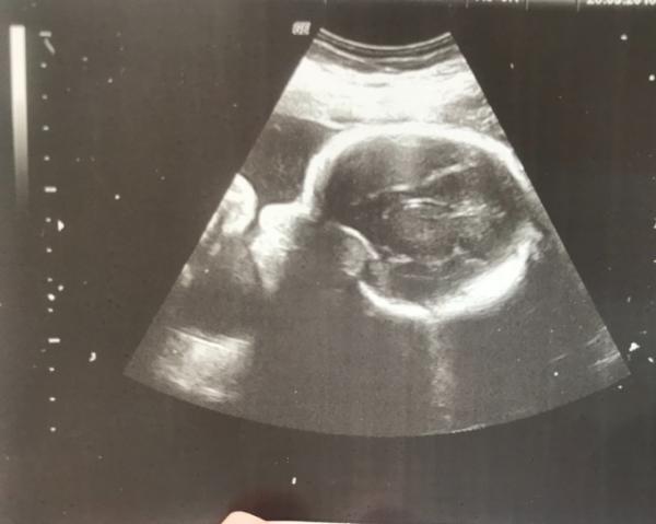 Bild zu Update - Forum für Dezember - Mamis