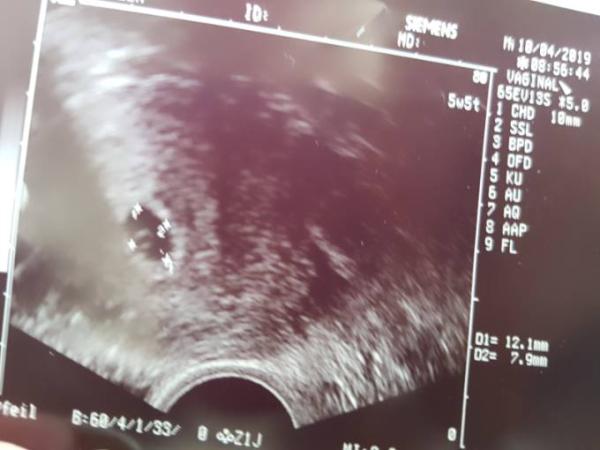 Bild zu 1 FA Termin gehabt - Forum für Dezember - Mamis
