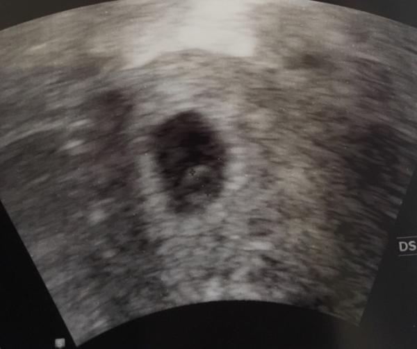 Bild zu 1. Ultraschall - Forum für Dezember - Mamis