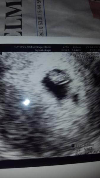 Bild zu Neues Ultraschall Bild - Forum für Dezember - Mamis