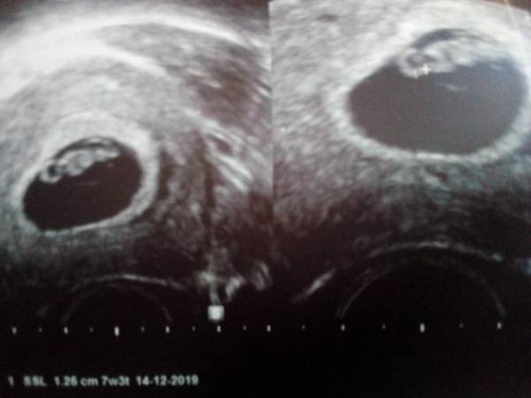 Bild zu Ultraschall *Silopo* - Forum für Dezember - Mamis