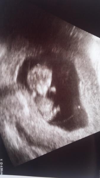 Bild zu 1. Screening - Forum für Dezember - Mamis