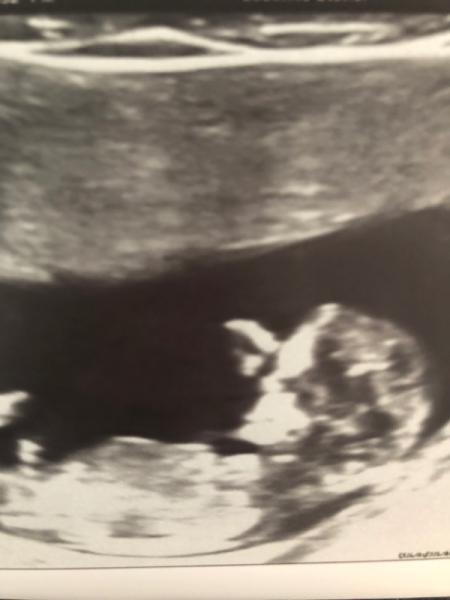 Bild zu Geschlecht? - Forum für Dezember - Mamis