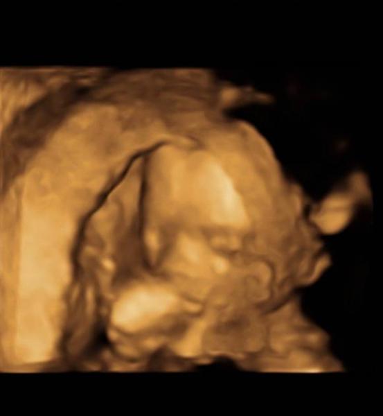 Bild zu Organultraschall - Forum für Dezember - Mamis