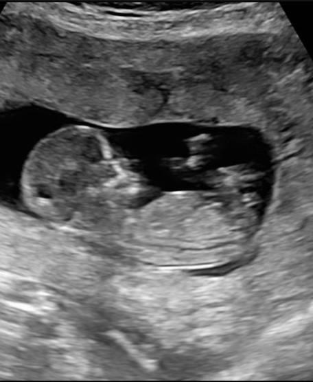 Bild zu Wirklich Mädchen? - Forum für Dezember - Mamis