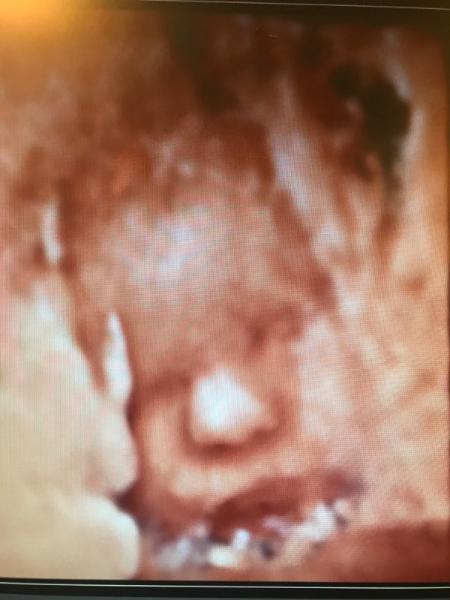 Bild zu 3 großer Ultraschall 🙃 - Forum für Dezember - Mamis