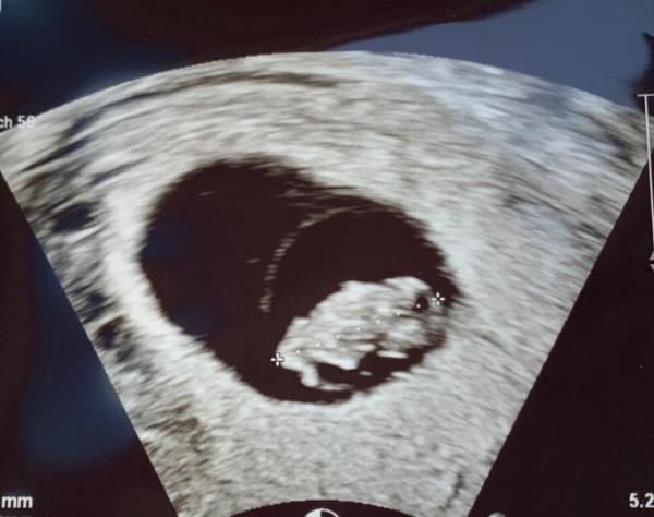 Bild zu 8+1 - Forum für Dezember - Mamis