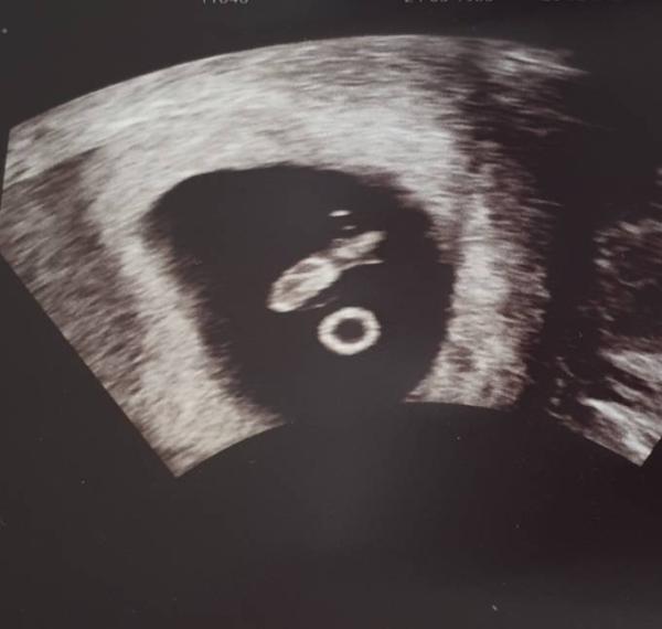 Bild zu Ich trau mich nun auch zu Euch - Forum für Dezember - Mamis
