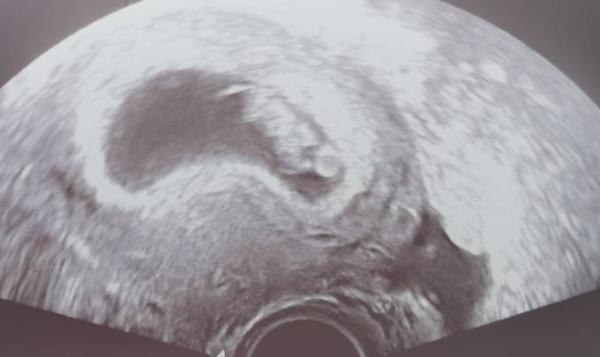 Bild zu Heute FA Termin - Forum für Dezember - Mamis
