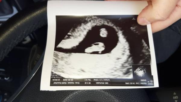 Bild zu Ultraschallbild 8. Wochehall - Forum für Dezember - Mamis