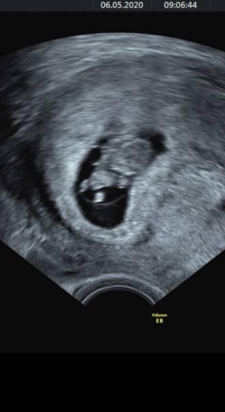 Bild zu Erster us - Forum für Dezember - Mamis
