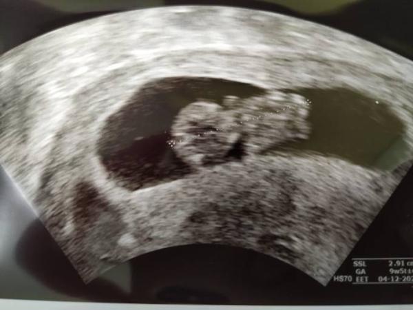 Bild zu Wird wohl nix mit unserem Weihnachts-Baby... - Forum für Dezember - Mamis