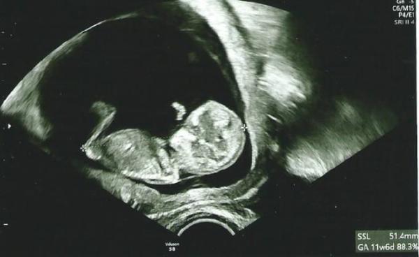 Bild zu Erleichtert und Glücklich - alles ist super! :-) - Forum für Dezember - Mamis