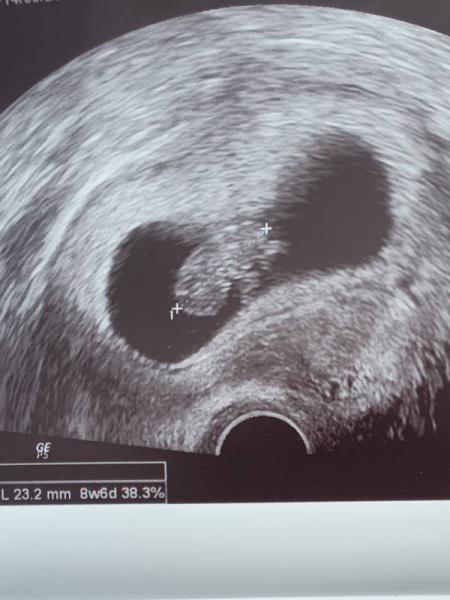 Bild zu Meine kleine Bohne (Gummibärchen) - Forum für Dezember - Mamis