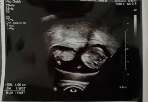 Bild zu 1. Großer us - Forum für Dezember - Mamis