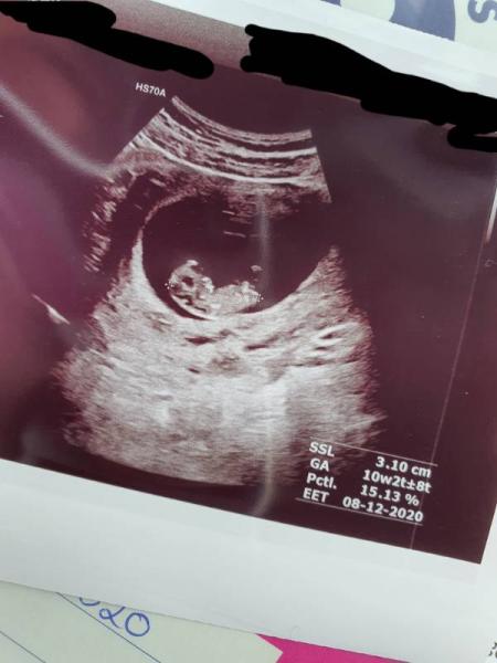 Bild zu Ultraschall - Verliebt ❤️ - Forum für Dezember - Mamis
