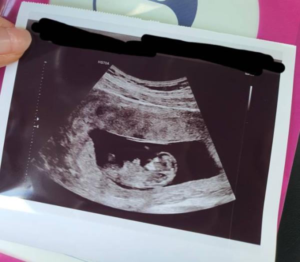 Bild zu Positive Nachrichten 🤗 - Forum für Dezember - Mamis