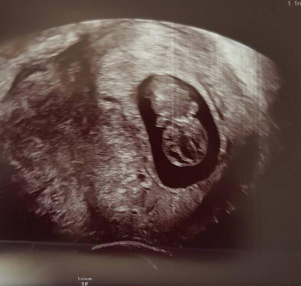 Bild zu Update - Forum für Dezember - Mamis