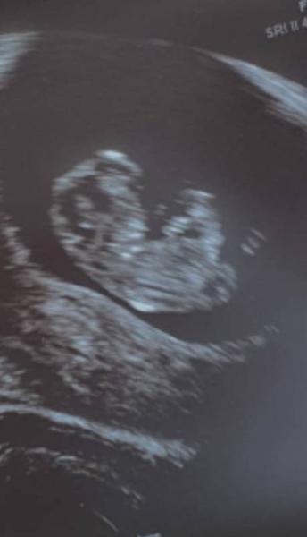 Bild zu Zweite Ultraschalluntersuchung - Forum für Dezember - Mamis